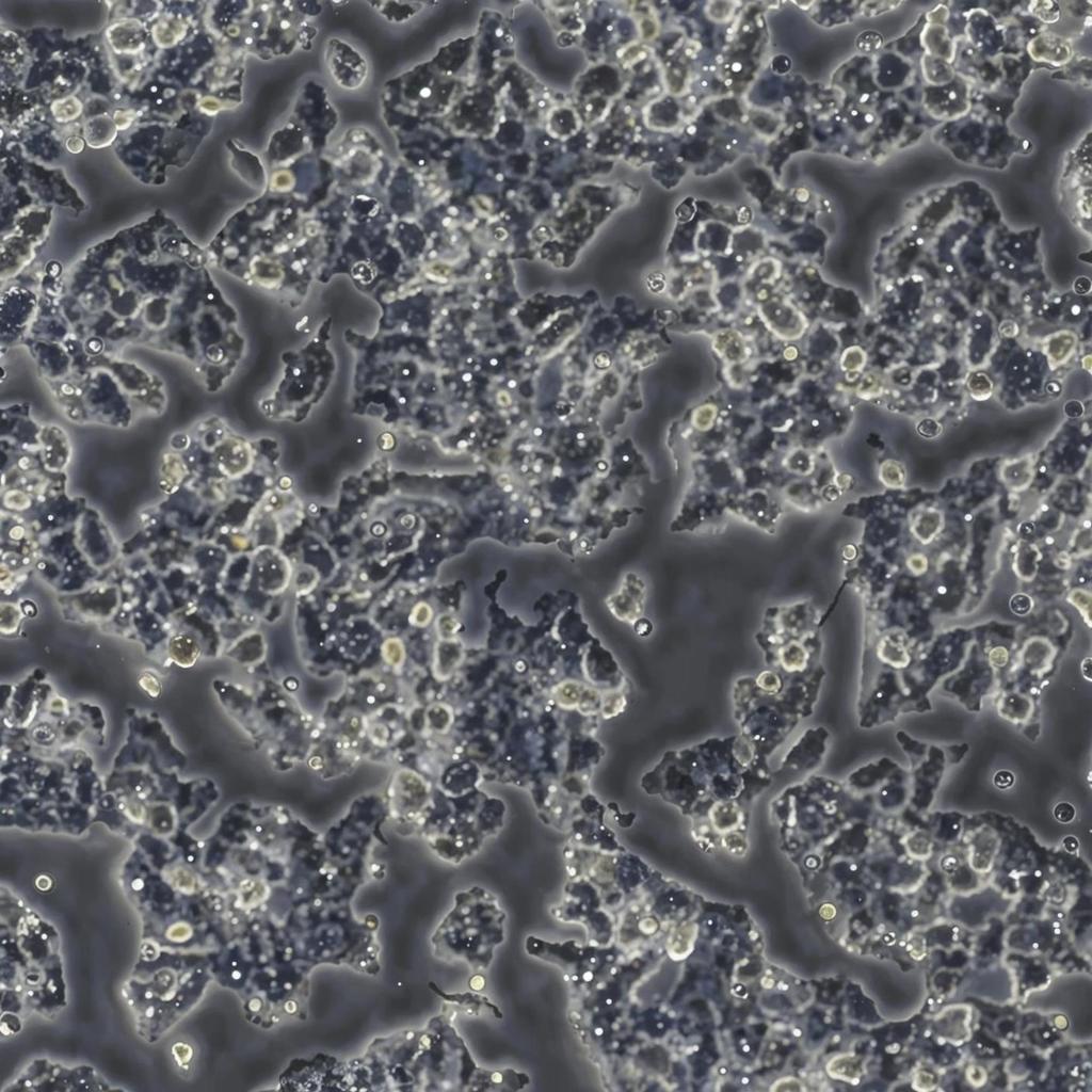 small cell liver cancer​