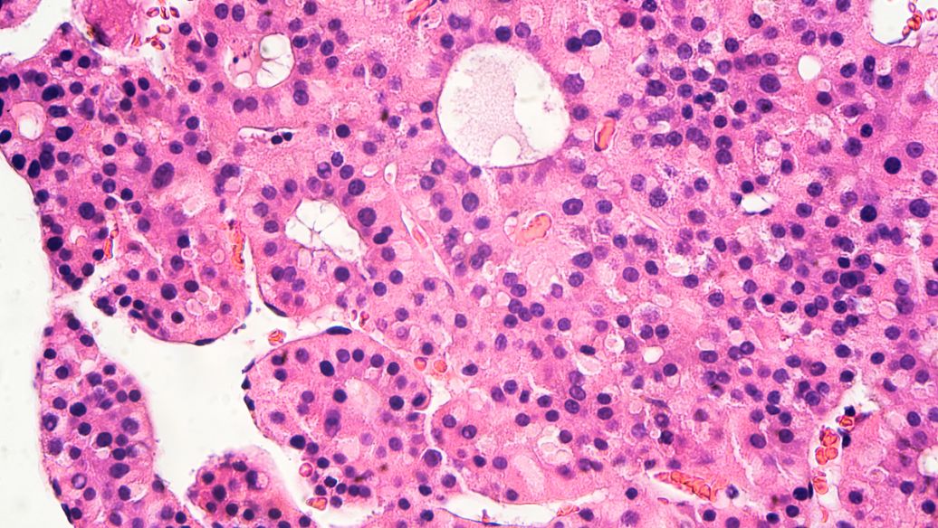 Human Hepatocytes display