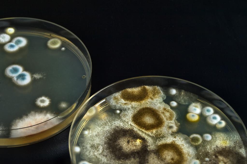 black mold on a petri dish