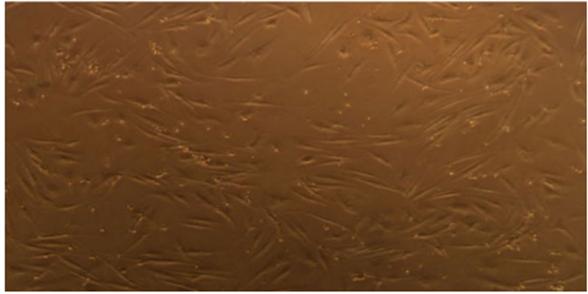 Human-Liver-derived-Mesenchymal-Stem-Cells